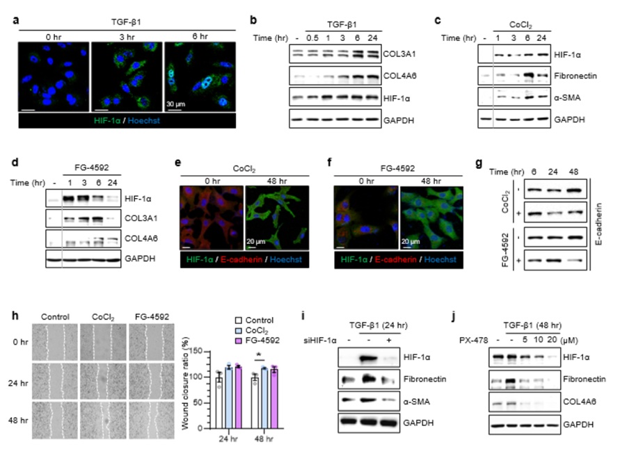 폐가 굳는 난치병, 새로운 치료 길이 열린다